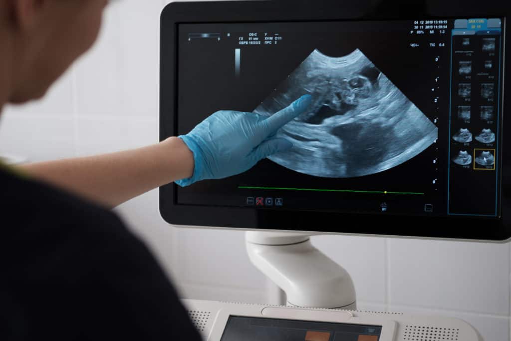 samsung veterinary ultrasound