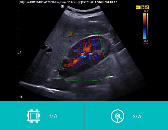 Hm70A ultrasound image