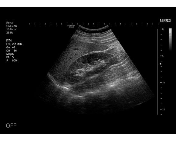 hs60 ultrasound image