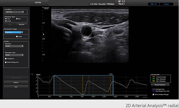 Hs70A ultrasound image