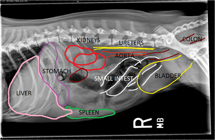 xray scan with organs labeled