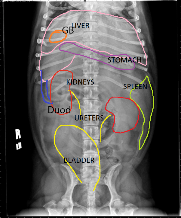 xray scan with organs labeled