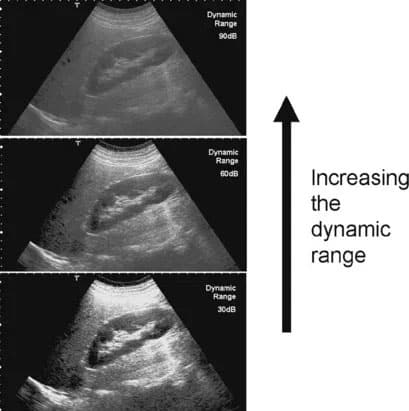 ultrasound dynamic range